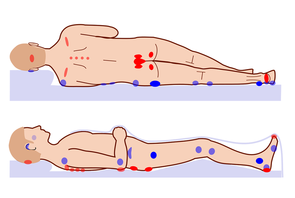 Posições de contato que ocasionam a lesão por pressão